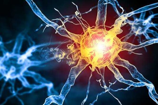 Guillain_Barre_neuron