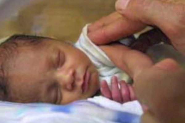 baby low birth weight
