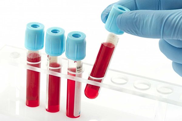 blood epruvetka