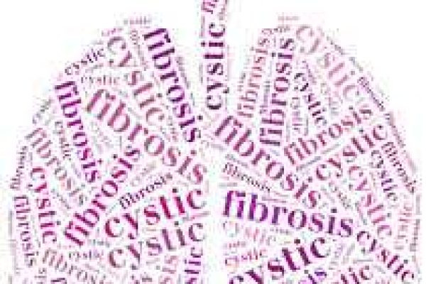 cystic fibrosis