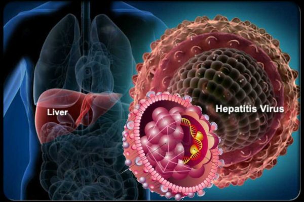 hepatitis B