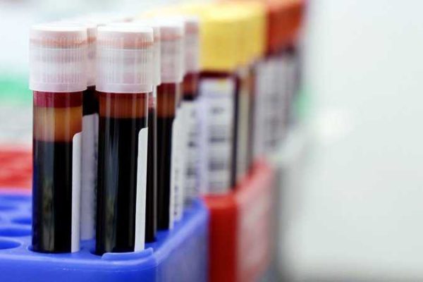 labtestblood